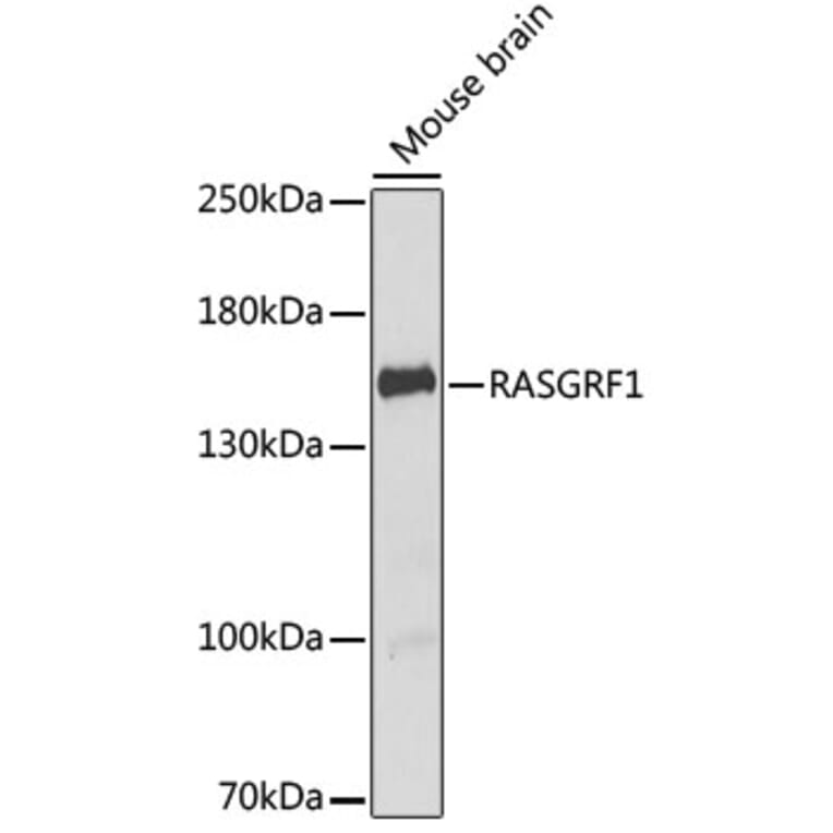 Western Blot - Anti-CDC25 Antibody (A12049) - Antibodies.com