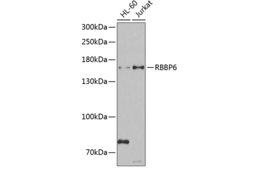 Western Blot - Anti-RBBP6 Antibody (A6966) - Antibodies.com