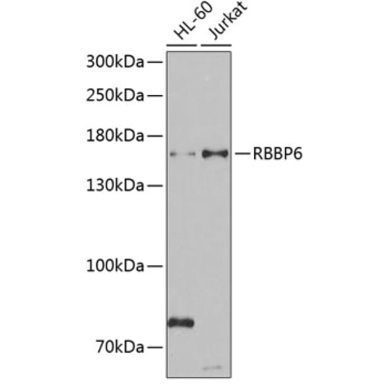 Western Blot - Anti-RBBP6 Antibody (A6966) - Antibodies.com