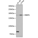 Western Blot - Anti-RBBP6 Antibody (A6966) - Antibodies.com