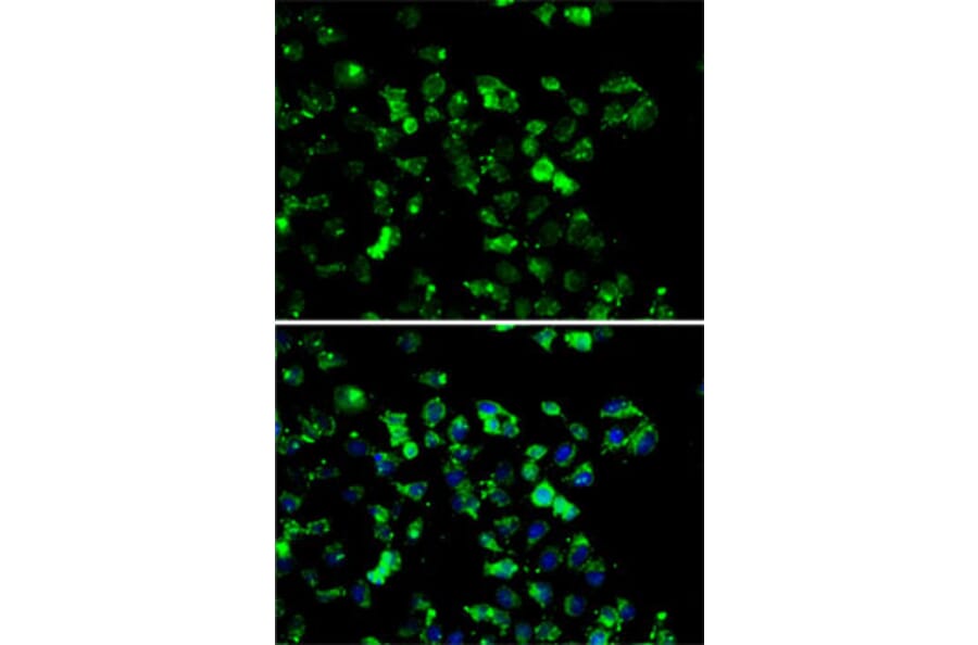 Immunofluorescence - Anti-RBBP6 Antibody (A6966) - Antibodies.com