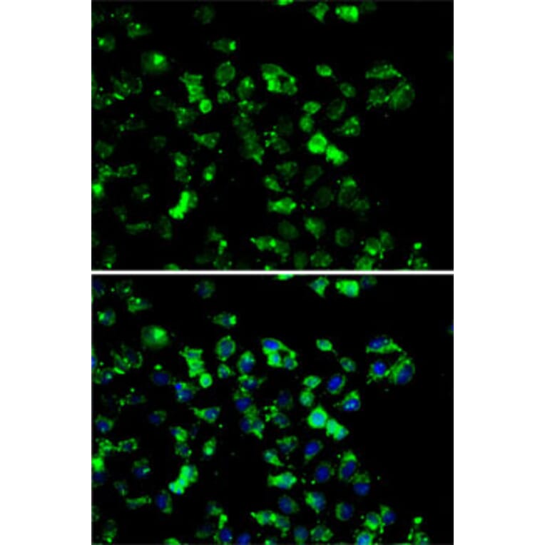 Immunofluorescence - Anti-RBBP6 Antibody (A6966) - Antibodies.com