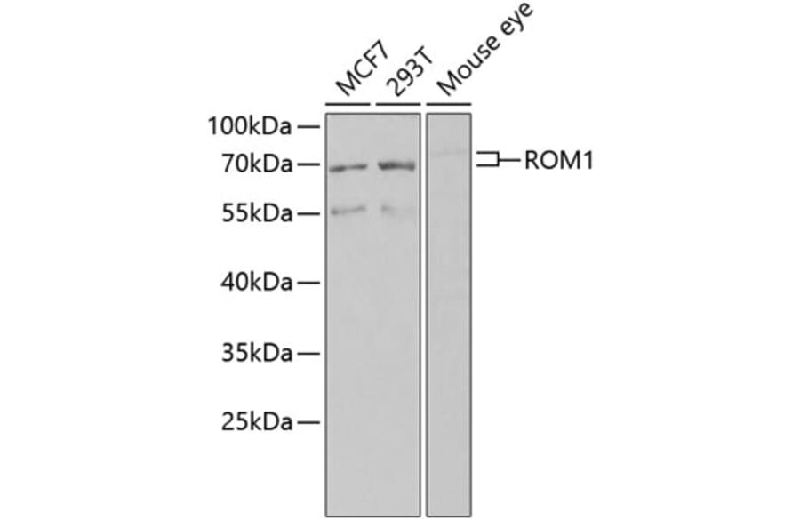 Western Blot - Anti-ROM1 Antibody (A12051) - Antibodies.com