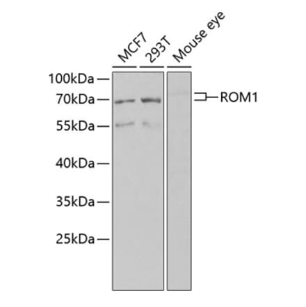 Western Blot - Anti-ROM1 Antibody (A12051) - Antibodies.com