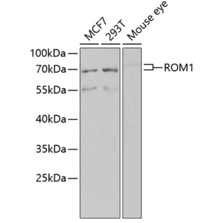 Western Blot - Anti-ROM1 Antibody (A12051) - Antibodies.com