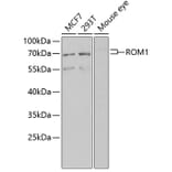 Western Blot - Anti-ROM1 Antibody (A12051) - Antibodies.com