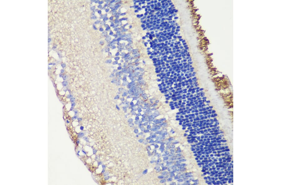Immunohistochemistry - Anti-ROM1 Antibody (A12051) - Antibodies.com