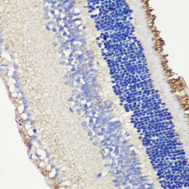 Immunohistochemistry - Anti-ROM1 Antibody (A12051) - Antibodies.com