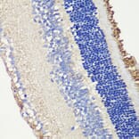 Immunohistochemistry - Anti-ROM1 Antibody (A12051) - Antibodies.com