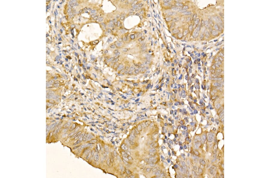 Immunohistochemistry - Anti-RPLP2 Antibody (A12053) - Antibodies.com