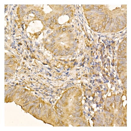 Immunohistochemistry - Anti-RPLP2 Antibody (A12053) - Antibodies.com