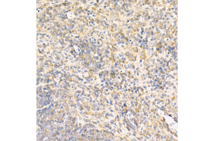 Immunohistochemistry - Anti-RPLP2 Antibody (A12053) - Antibodies.com
