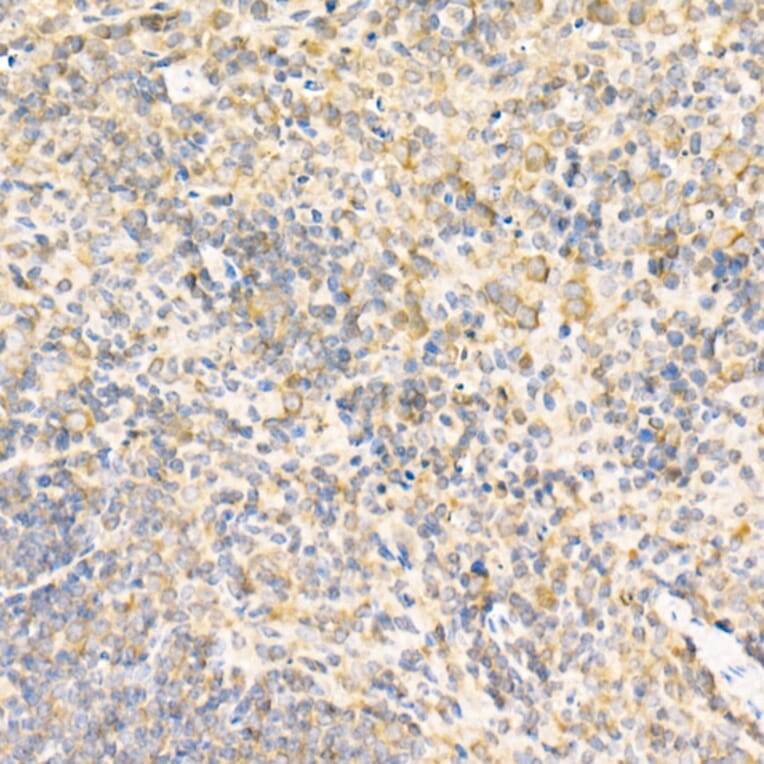 Immunohistochemistry - Anti-RPLP2 Antibody (A12053) - Antibodies.com