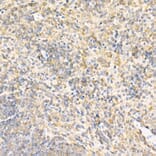 Immunohistochemistry - Anti-RPLP2 Antibody (A12053) - Antibodies.com