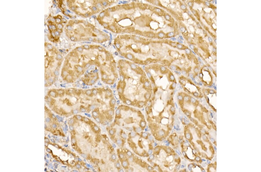 Immunohistochemistry - Anti-RPLP2 Antibody (A12053) - Antibodies.com