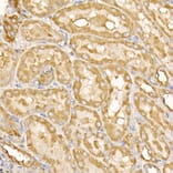 Immunohistochemistry - Anti-RPLP2 Antibody (A12053) - Antibodies.com
