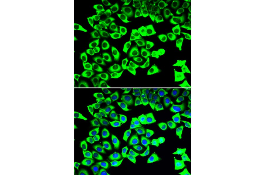 Immunofluorescence - Anti-RPLP2 Antibody (A12053) - Antibodies.com