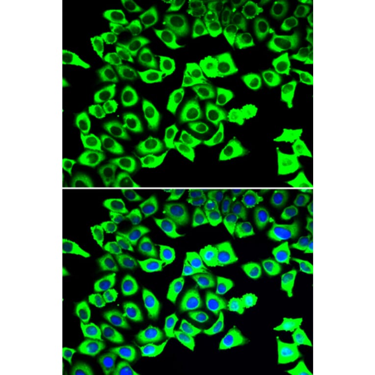 Immunofluorescence - Anti-RPLP2 Antibody (A12053) - Antibodies.com