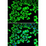 Immunofluorescence - Anti-RPLP2 Antibody (A12053) - Antibodies.com