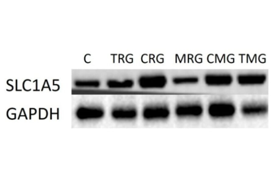 Western Blot - Anti-SLC1A5/ASCT2 Antibody - Antibodies.com