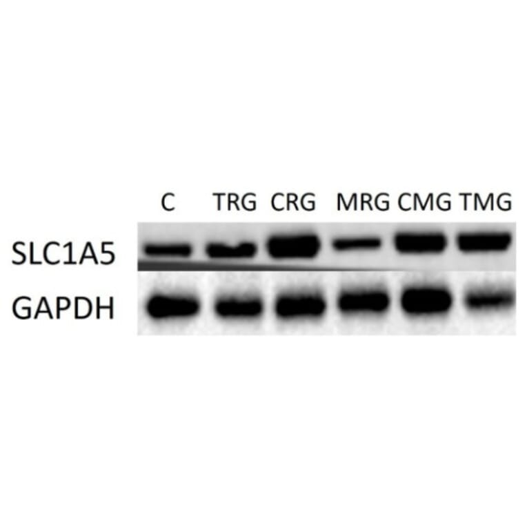 Western Blot - Anti-SLC1A5/ASCT2 Antibody - Antibodies.com