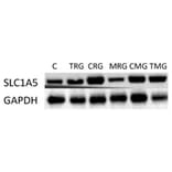 Western Blot - Anti-SLC1A5/ASCT2 Antibody - Antibodies.com