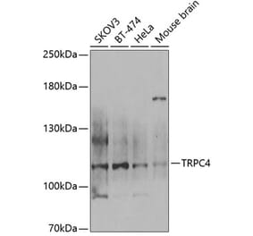 Western Blot - Anti-TRPC4 Antibody (A12055) - Antibodies.com