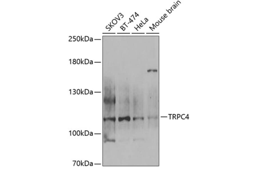 Western Blot - Anti-TRPC4 Antibody (A12055) - Antibodies.com