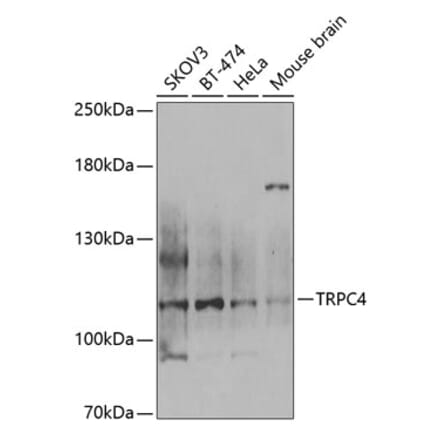 Western Blot - Anti-TRPC4 Antibody (A12055) - Antibodies.com