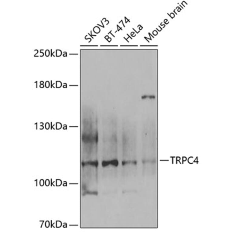 Western Blot - Anti-TRPC4 Antibody (A12055) - Antibodies.com