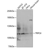 Western Blot - Anti-TRPC4 Antibody (A12055) - Antibodies.com