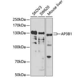Western Blot - Anti-HPS2 Antibody (A12057) - Antibodies.com