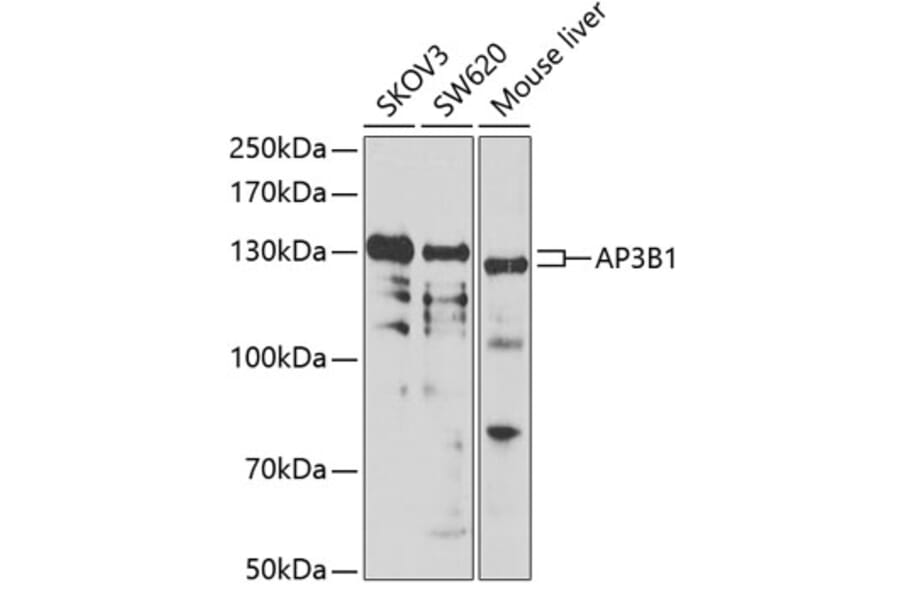 Western Blot - Anti-HPS2 Antibody (A12057) - Antibodies.com
