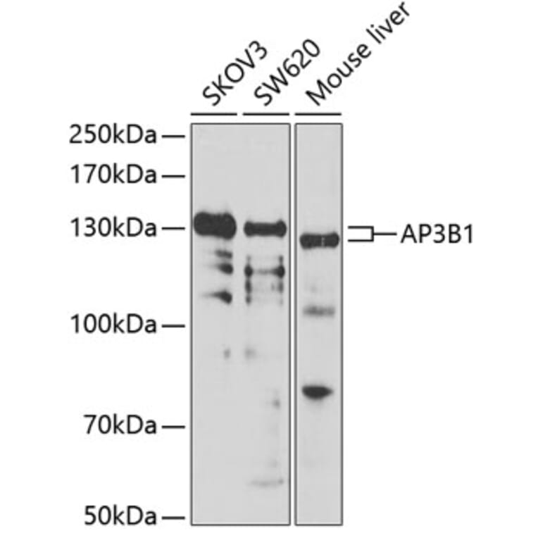 Western Blot - Anti-HPS2 Antibody (A12057) - Antibodies.com