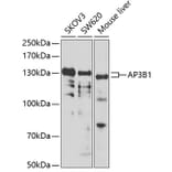 Western Blot - Anti-HPS2 Antibody (A12057) - Antibodies.com