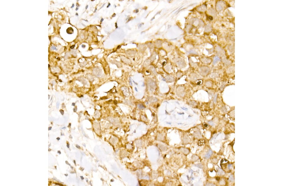 Immunohistochemistry - Anti-HPS2 Antibody (A12057) - Antibodies.com