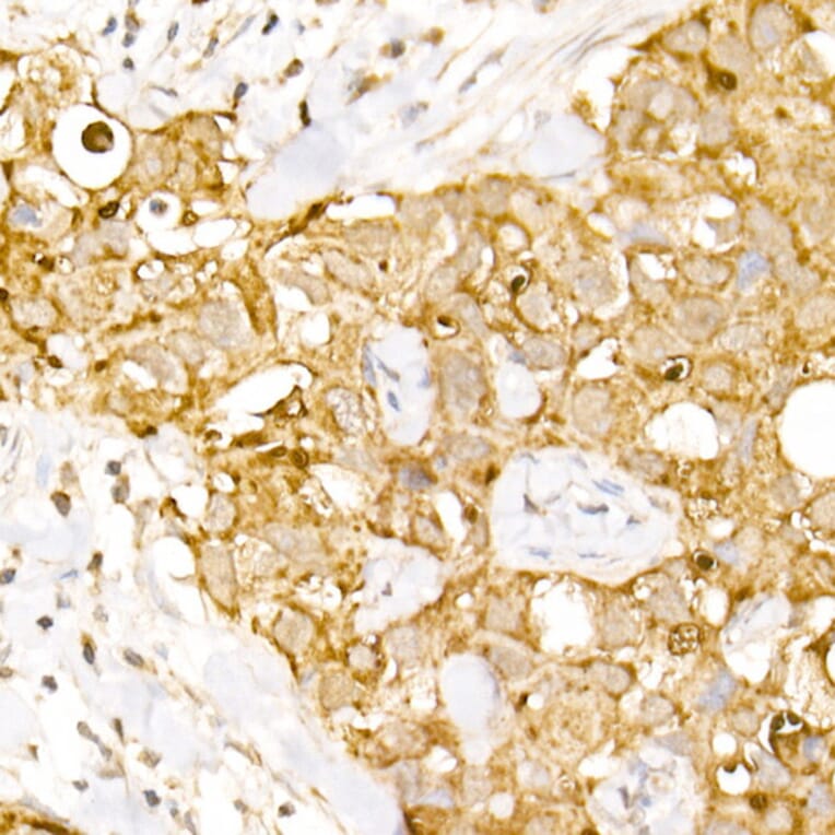 Immunohistochemistry - Anti-HPS2 Antibody (A12057) - Antibodies.com