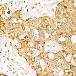 Immunohistochemistry - Anti-HPS2 Antibody (A12057) - Antibodies.com