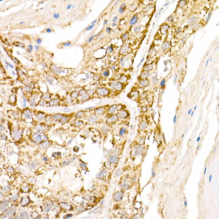 Immunohistochemistry - Anti-HPS2 Antibody (A12057) - Antibodies.com