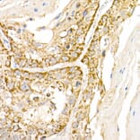Immunohistochemistry - Anti-HPS2 Antibody (A12057) - Antibodies.com