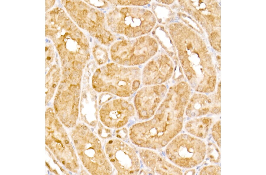 Immunohistochemistry - Anti-HPS2 Antibody (A12057) - Antibodies.com