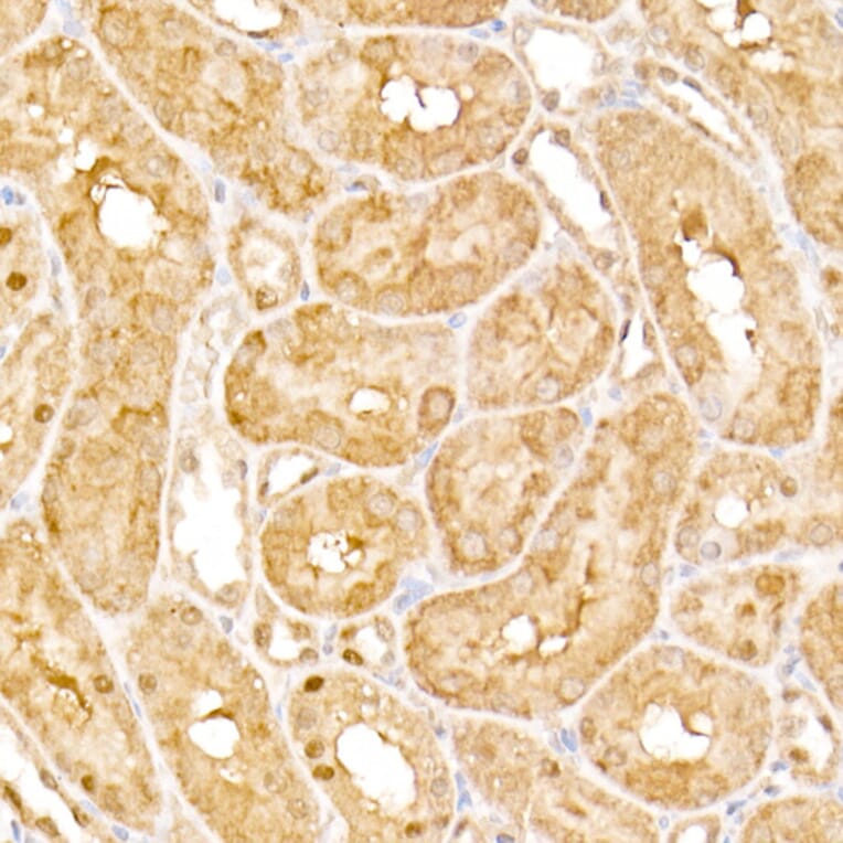 Immunohistochemistry - Anti-HPS2 Antibody (A12057) - Antibodies.com
