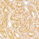 Immunohistochemistry - Anti-HPS2 Antibody (A12057) - Antibodies.com