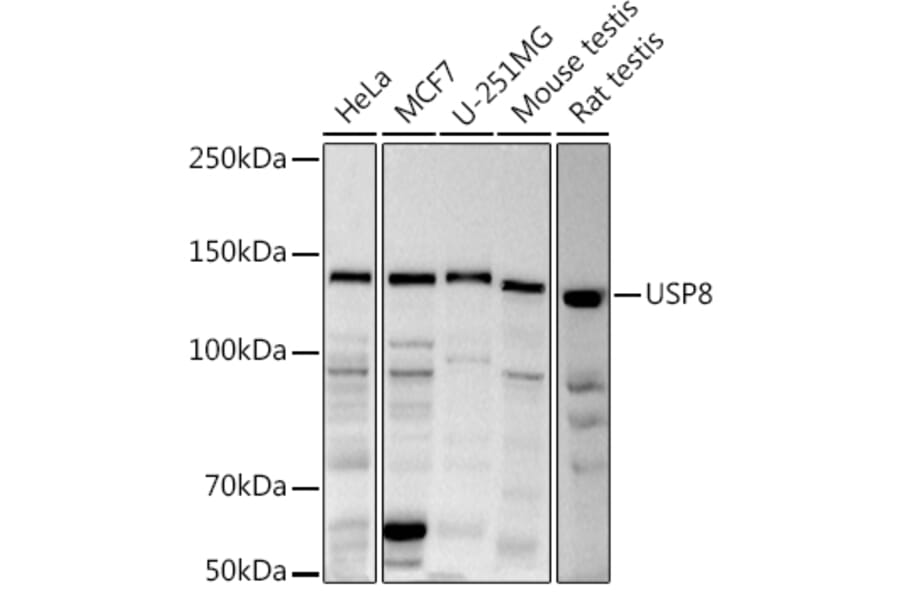 Western Blot - Anti-UBPY/USP8 Antibody (A12058) - Antibodies.com
