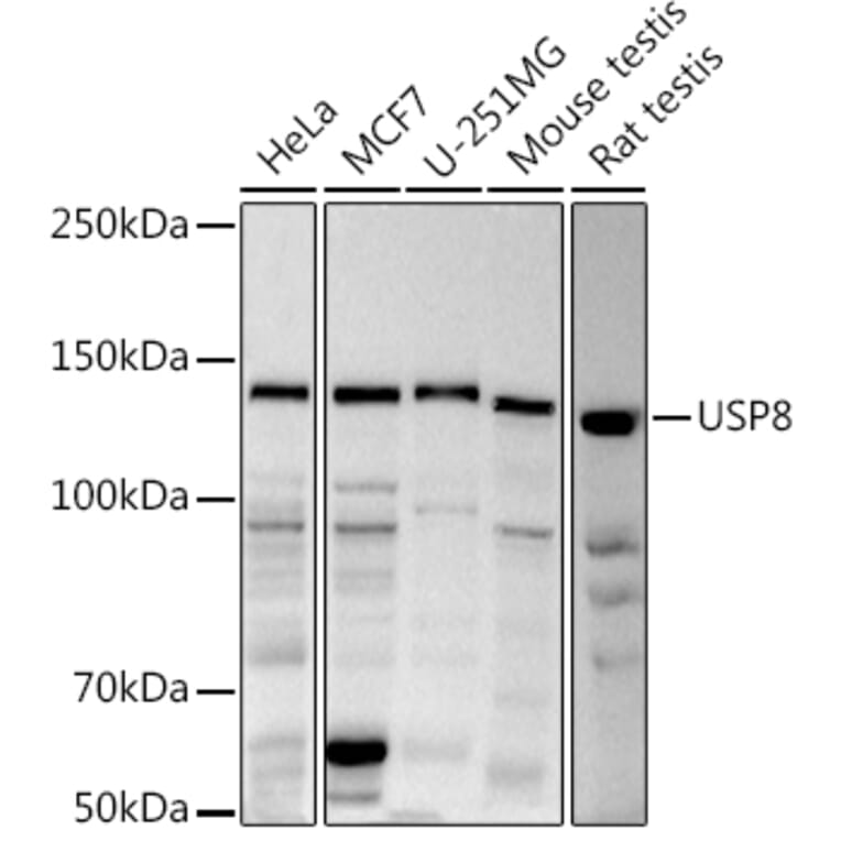 Western Blot - Anti-UBPY/USP8 Antibody (A12058) - Antibodies.com