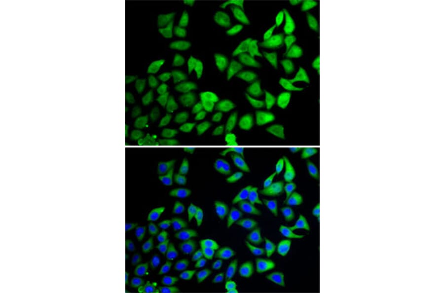 Immunofluorescence - Anti-UBPY/USP8 Antibody (A12058) - Antibodies.com