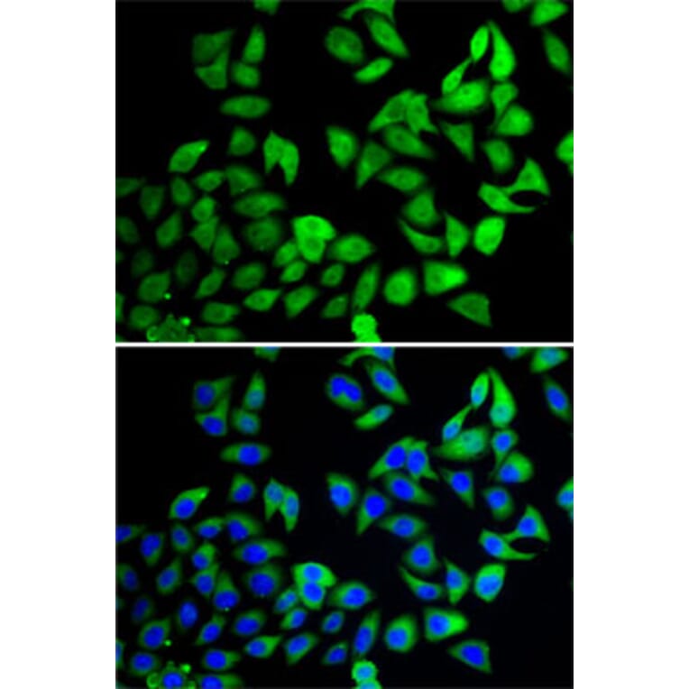 Immunofluorescence - Anti-UBPY/USP8 Antibody (A12058) - Antibodies.com