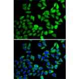 Immunofluorescence - Anti-UBPY/USP8 Antibody (A12058) - Antibodies.com