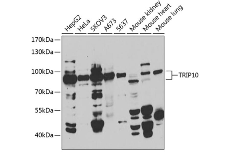 Western Blot - Anti-Cip4 Antibody (A12060) - Antibodies.com