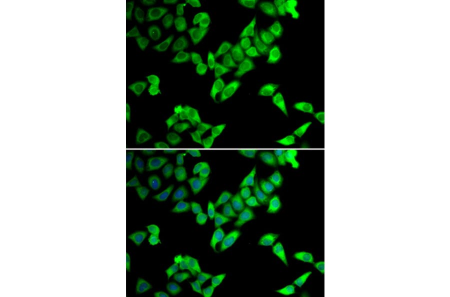 Immunofluorescence - Anti-Cip4 Antibody (A12060) - Antibodies.com